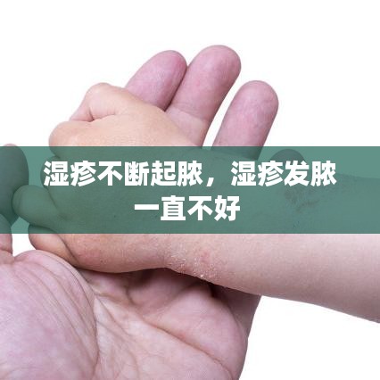 湿疹不断起脓,湿疹发脓一直不好