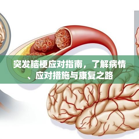 突发脑梗应对指南,了解病情、应对措施与康复之路