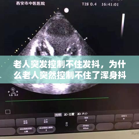 老人突发控制不住发抖，为什么老人突然控制不住了浑身抖动 
