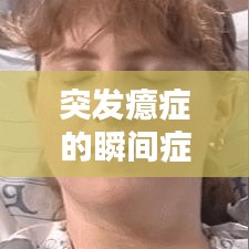 突发癔症的瞬间症状表现,识别与应对的关键时刻