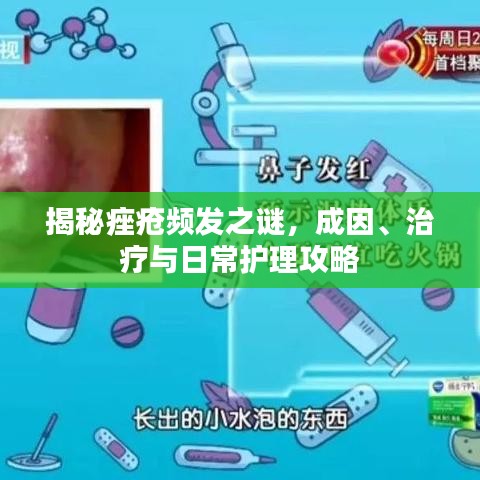 揭秘痤疮频发之谜,成因、治疗与日常护理攻略