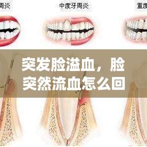 突发脸溢血,脸突然流血怎么回事