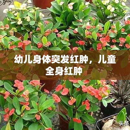 幼儿身体突发红肿,儿童全身红肿