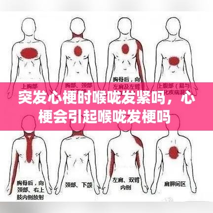 突发心梗时喉咙发紧吗，心梗会引起喉咙发梗吗 