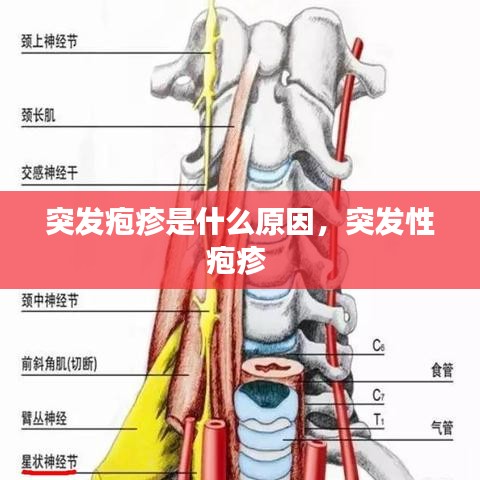 突发疱疹是什么原因,突发性疱疹
