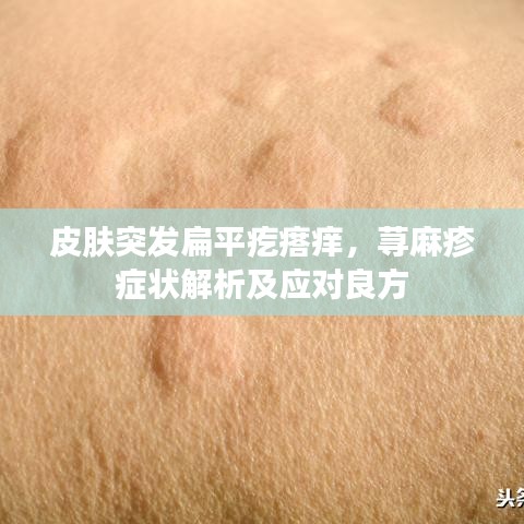 皮肤突发扁平疙瘩痒，荨麻疹症状解析及应对良方