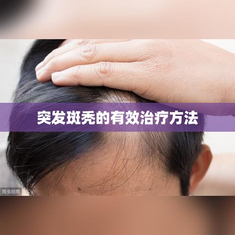 突发斑秃的有效治疗方法