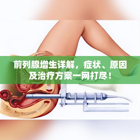 前列腺增生详解，症状、原因及治疗方案一网打尽！