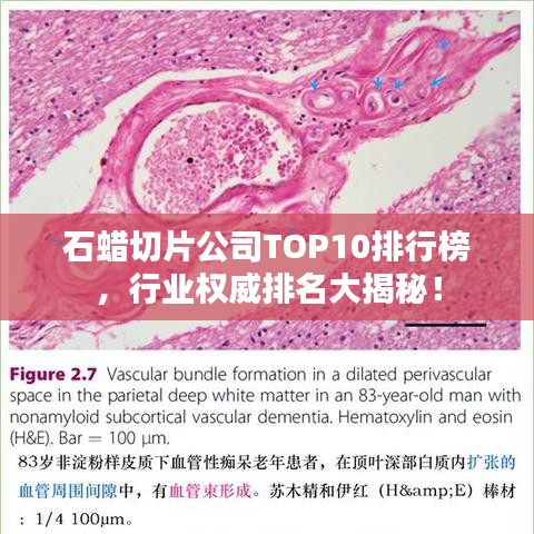 石蜡切片公司TOP10排行榜,行业权威排名大揭秘!