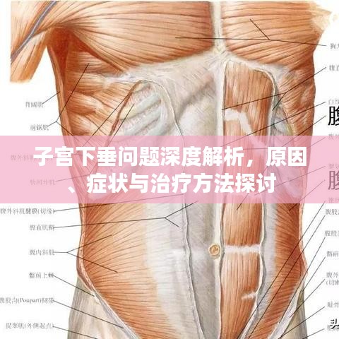 子宫下垂问题深度解析,原因、症状与治疗方法探讨