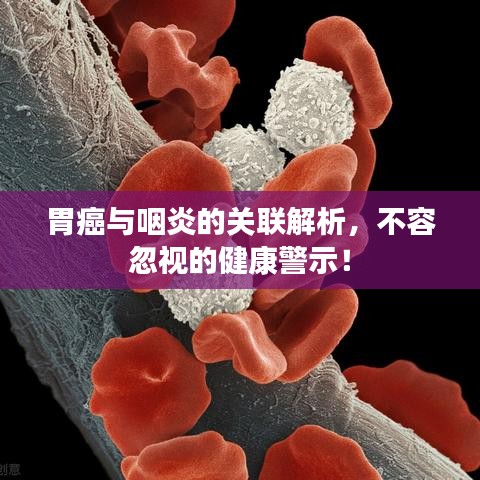 胃癌与咽炎的关联解析,不容忽视的健康警示!