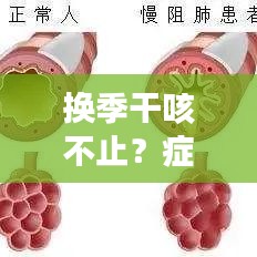 换季干咳不止?症状解析与应对方案全攻略